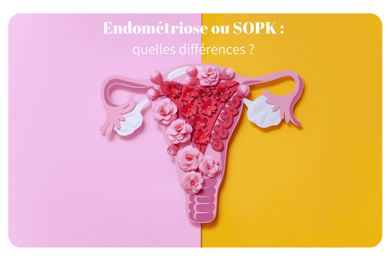 Illustration sur les différences entre endométriose et SOPK avec des éléments floraux décoratifs